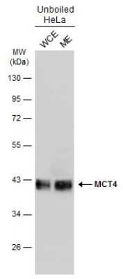 Western Blot: SLC16A3 Antibody [NBP3-13033]