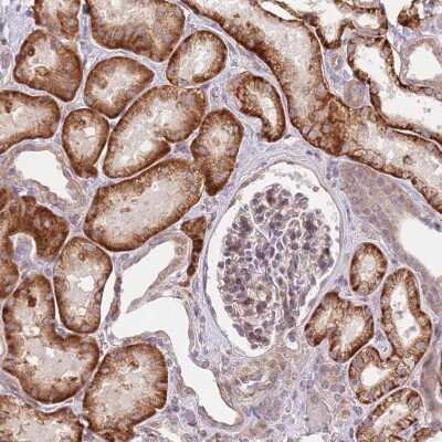 Immunohistochemistry: SLC16A4 Antibody [NBP2-13315]