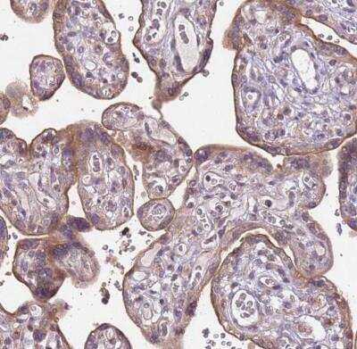 Immunohistochemistry-Paraffin: SLC16A4 Antibody [NBP2-13315]
