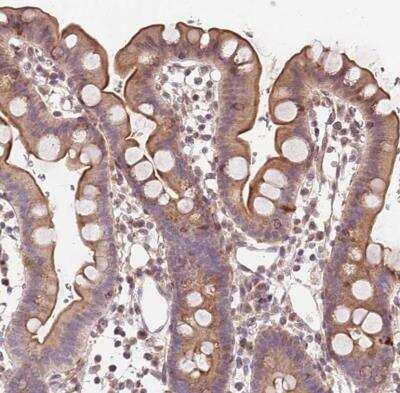 Immunohistochemistry-Paraffin: SLC16A4 Antibody [NBP2-13315]