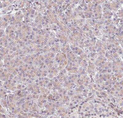 Immunohistochemistry-Paraffin: SLC16A4 Antibody [NBP2-13315]