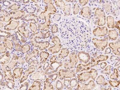 Immunohistochemistry-Paraffin: SLC16A4 Antibody [NBP2-98155]