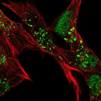 Immunocytochemistry/ Immunofluorescence: SLC16A6 Antibody [NBP2-56865]