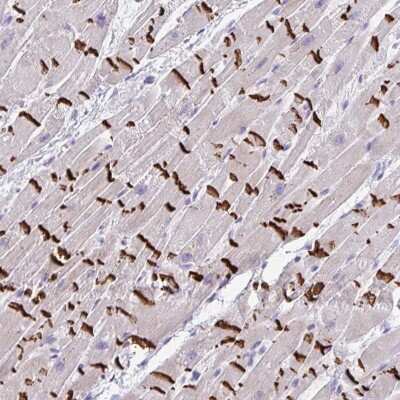 Immunohistochemistry: SLC16A6 Antibody [NBP2-31578]