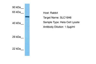 Western Blot: SLC16A6 Antibody [NBP2-88284]