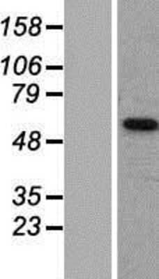 Western Blot: SLC16A6 Overexpression Lysate [NBP2-07842]