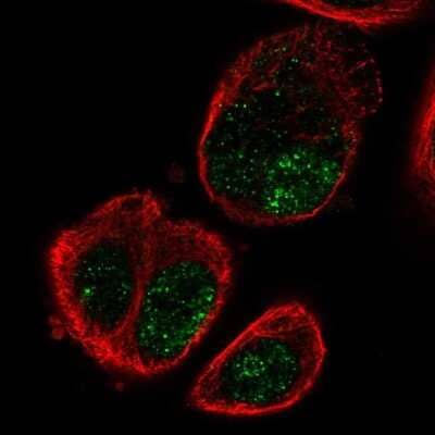 Immunocytochemistry/ Immunofluorescence: SLC16A9 Antibody [NBP2-31030]