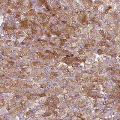 Immunohistochemistry-Paraffin: SLC16A9 Antibody [NBP2-31030]