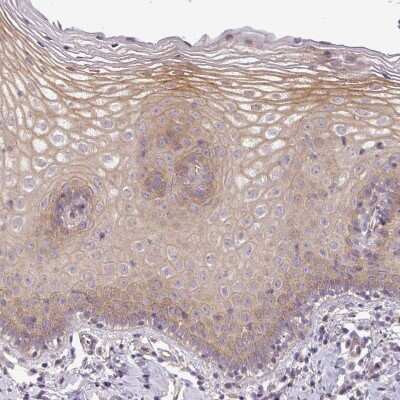 Immunohistochemistry-Paraffin: SLC16A9 Antibody [NBP2-31030]