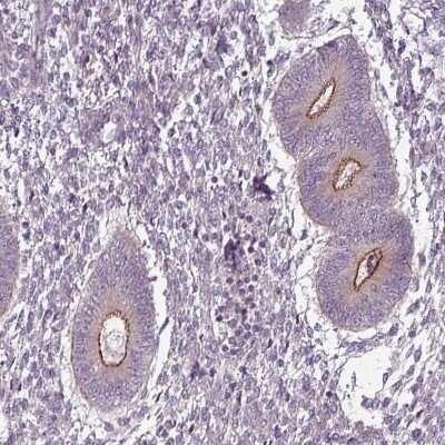 Immunohistochemistry-Paraffin: SLC16A9 Antibody [NBP2-31030]