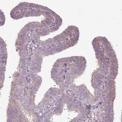 Immunohistochemistry-Paraffin: SLC16A9 Antibody [NBP2-31030]