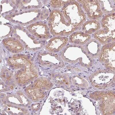 Immunohistochemistry-Paraffin: SLC16A9 Antibody [NBP2-31030]