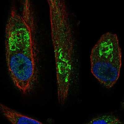 Immunocytochemistry/ Immunofluorescence: SLC17A1/NPT Antibody [NBP2-55004]