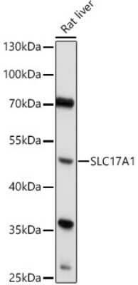 Western Blot: SLC17A1/NPT AntibodyAzide and BSA Free [NBP2-94745]