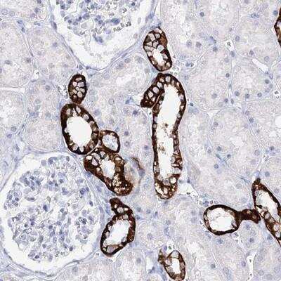 Immunohistochemistry-Paraffin: SLC17A2 Antibody [NBP1-82536]