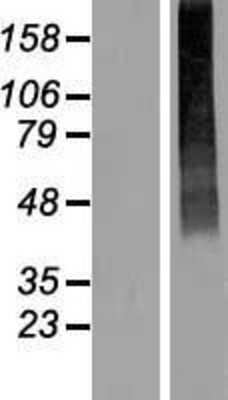 Western Blot: SLC17A2 Overexpression Lysate [NBL1-16020]