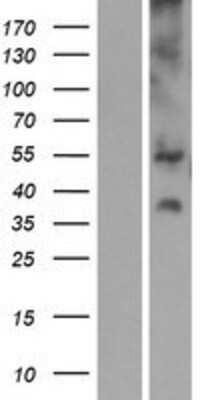 Western Blot: SLC17A3 Overexpression Lysate [NBP2-08311]