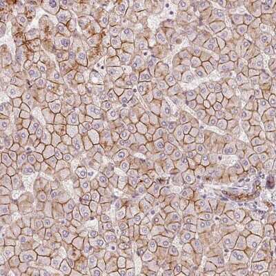 Immunohistochemistry-Paraffin: SLC17A4 Antibody [NBP2-57090]