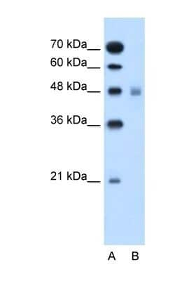 Western Blot: SLC17A4 Antibody [NBP1-59883]