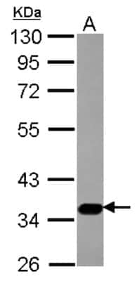 Western Blot: Sialin/SLC17A5 Antibody [NBP2-20383]