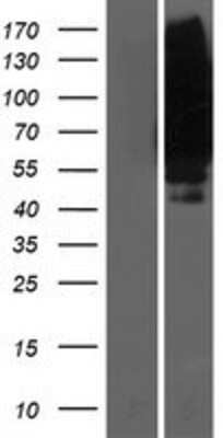 Western Blot: Reduced Folate Carrier/SLC19A1 Overexpression Lysate [NBP2-04767]