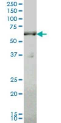 Western Blot: SLC19A2 Antibody (5B10) [H00010560-M10]