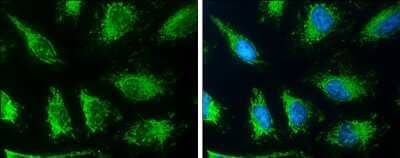 Immunocytochemistry/ Immunofluorescence: SLC19A2 Antibody [NBP3-12981]