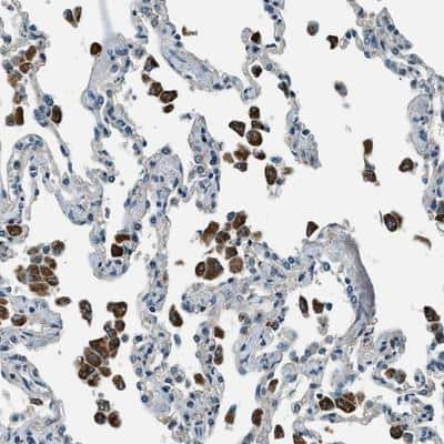 Immunohistochemistry-Paraffin: SLC19A2 Antibody [NBP1-86944]