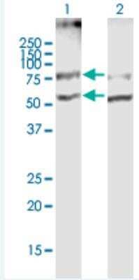 Western Blot: SLC19A2 Antibody [H00010560-B01P-50ug]