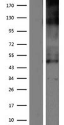 Western Blot: SLC19A2 Overexpression Lysate [NBP2-07548]