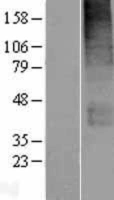 Western Blot: SLC19A3 Overexpression Lysate [NBP2-06216]