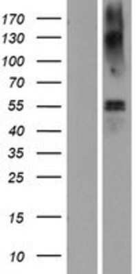 Western Blot: EAAT1/GLAST-1/SLC1A3 Overexpression Lysate [NBP2-10257]