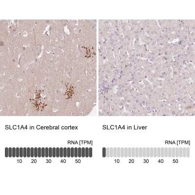 Immunohistochemistry-Paraffin: SLC1A4 Antibody [NBP2-38226]