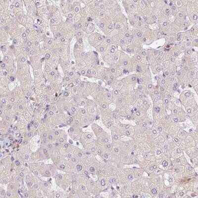 Immunohistochemistry-Paraffin: SLC1A4 Antibody [NBP2-38226]