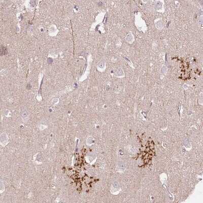 Immunohistochemistry-Paraffin: SLC1A4 Antibody [NBP2-38226]