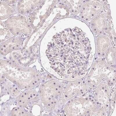 Immunohistochemistry-Paraffin: SLC1A4 Antibody [NBP2-38226]