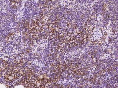 Immunohistochemistry-Paraffin: SLC1A4 Antibody [NBP2-97677]