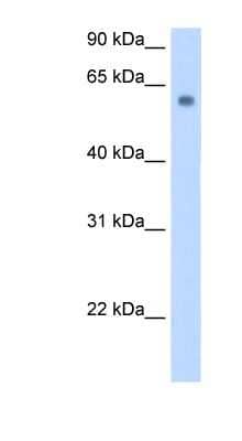 Western Blot: SLC1A4 Antibody [NBP1-60038]