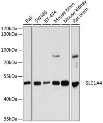 Western Blot: SLC1A4 AntibodyBSA Free [NBP2-94129]