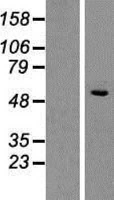 Western Blot: SLC1A4 Overexpression Lysate [NBP2-08043]