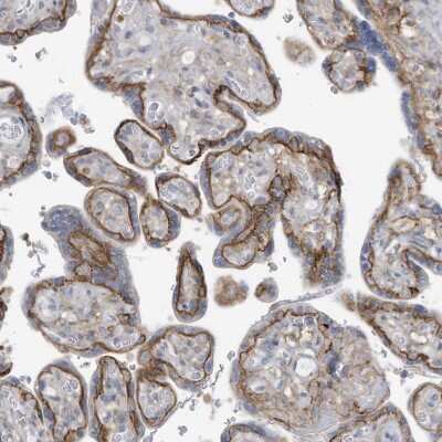 Immunohistochemistry-Paraffin: SLC1A5 Antibody [NBP1-89327]
