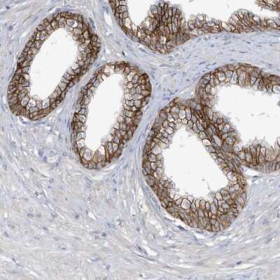 Immunohistochemistry-Paraffin: SLC1A5 Antibody [NBP1-89327]