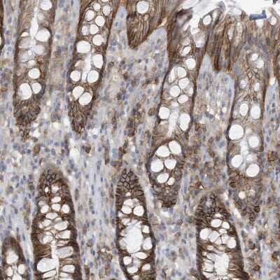 Immunohistochemistry-Paraffin: SLC1A5 Antibody [NBP1-89327]