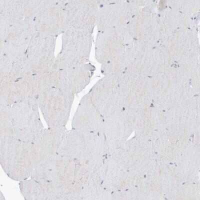 Immunohistochemistry-Paraffin: SLC1A5 Antibody [NBP1-89327]
