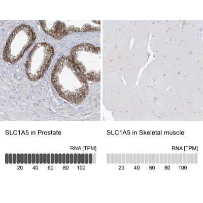 Immunohistochemistry-Paraffin: SLC1A5 Antibody [NBP1-89327]