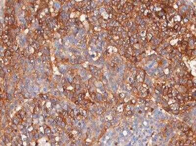 Immunohistochemistry-Paraffin: SLC1A5 Antibody [NBP1-89327]