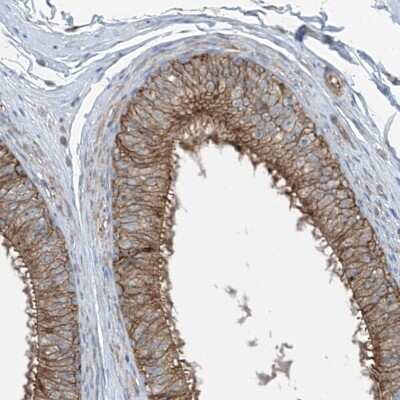 Immunohistochemistry-Paraffin: SLC1A5 Antibody [NBP1-89328]