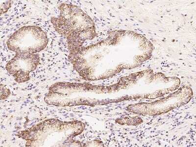 Immunohistochemistry-Paraffin: SLC1A5 Antibody [NBP2-97567]