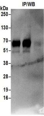 Immunoprecipitation: SLC1A5 Antibody [NBP2-32238]