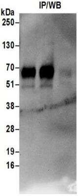 Immunoprecipitation: SLC1A5 Antibody [NBP2-32239]